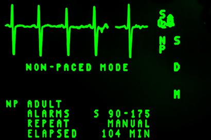 electrocardiogram.jpg